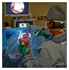 Knee Arthroscopic Surgery - Dr Leon Mead. Naples, Florida