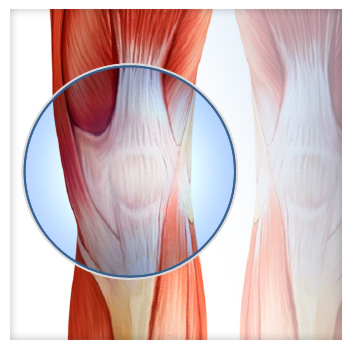 Knee Surgery - Naples - Dr. Mead